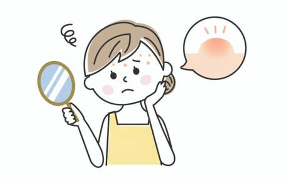 白ニキビにお悩みの方は半田のフィオーレにご相談ください
